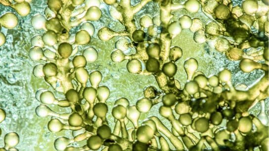 Op-Ed: Diving Into the Potential of Microalgae for Human Health and Environmental Sustainability